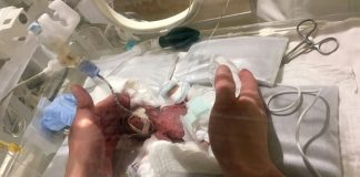 Mini miracle: 'Record-breaking' preemie leaves Tokyo hospital