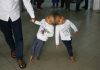 Hungarian doctors separate Bangladeshi twins joined at head