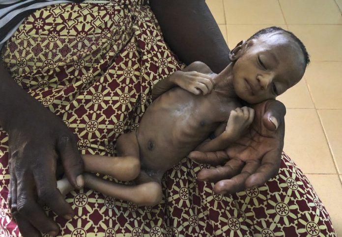 sky news africa Virus-linked hunger tied to 10,000 child deaths each month