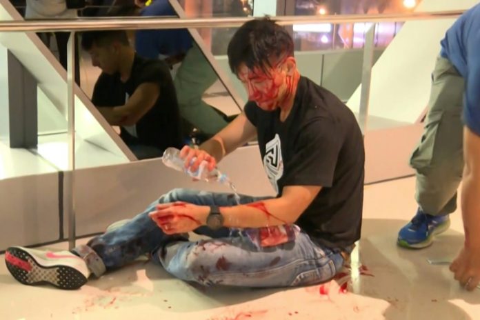 Anger soars over vicious mob attack on Hong Kong protesters