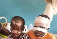 Skynewsafrica Son, daughter burnt by father for alleged witchcraft